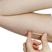 implante-anticoncepcional-implanon